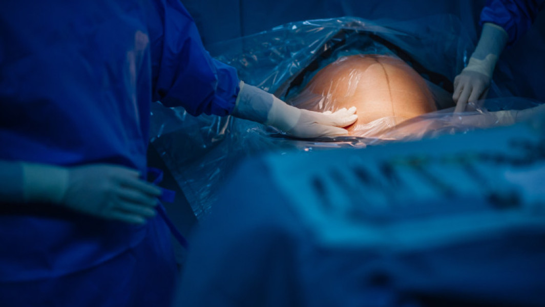 Guvernul turc interzice cezarienele planificate în clinicile private